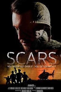 Scars