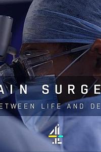 Brain Surgeons: Between Life and Death